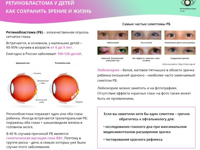 Что такое ретинобластома?